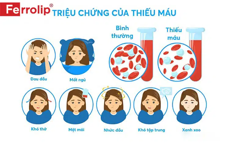 Triệu chứng bệnh thiếu máu