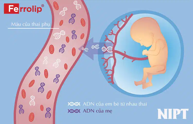 Xét nghiệm NIPT có thể biết được giới tính thai nhi sớm