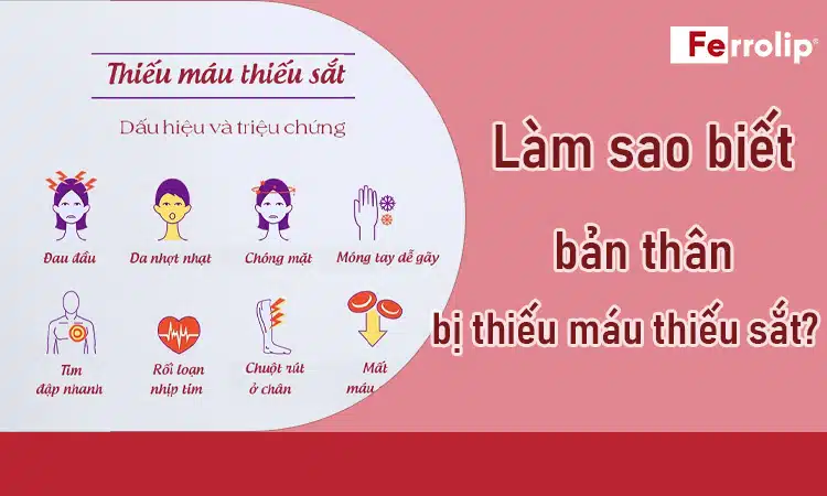 lam-sao-biet-minh-bi-thieu-mau