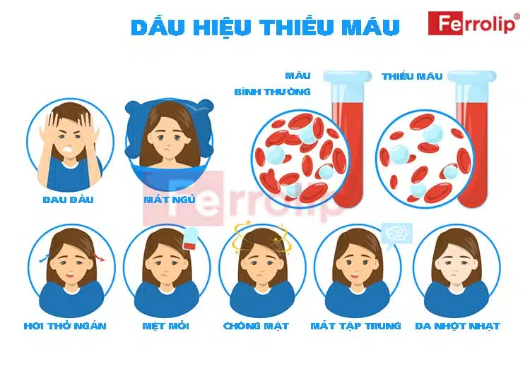 Dấu hiệu thiếu máu