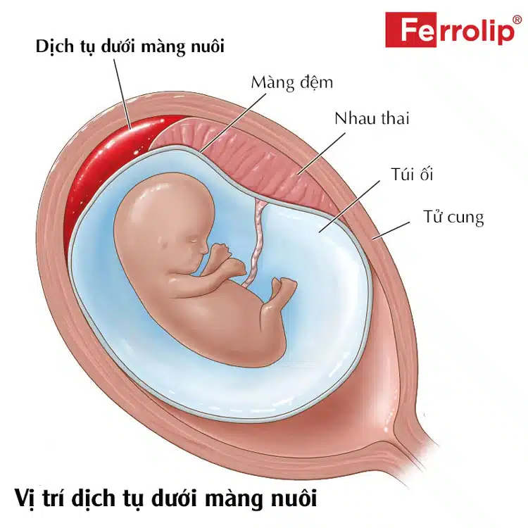 tụ dịch dưới màng nuôi