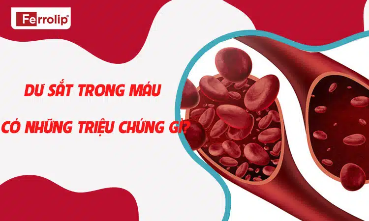 Dư sắt trong máu có những triệu chứng gì?