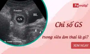 chỉ số GS trong siêu âm thai là gì