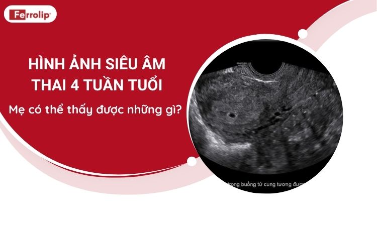 hình ảnh siêu âm thai 4 tuần tuổi