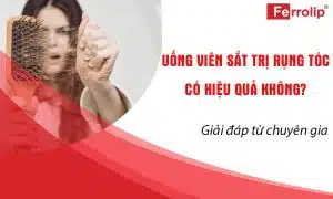 uống viên sắt trị rụng tóc