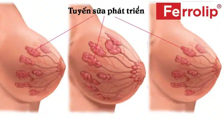 Tuyến sữa phát triển khiến ngực căng tức