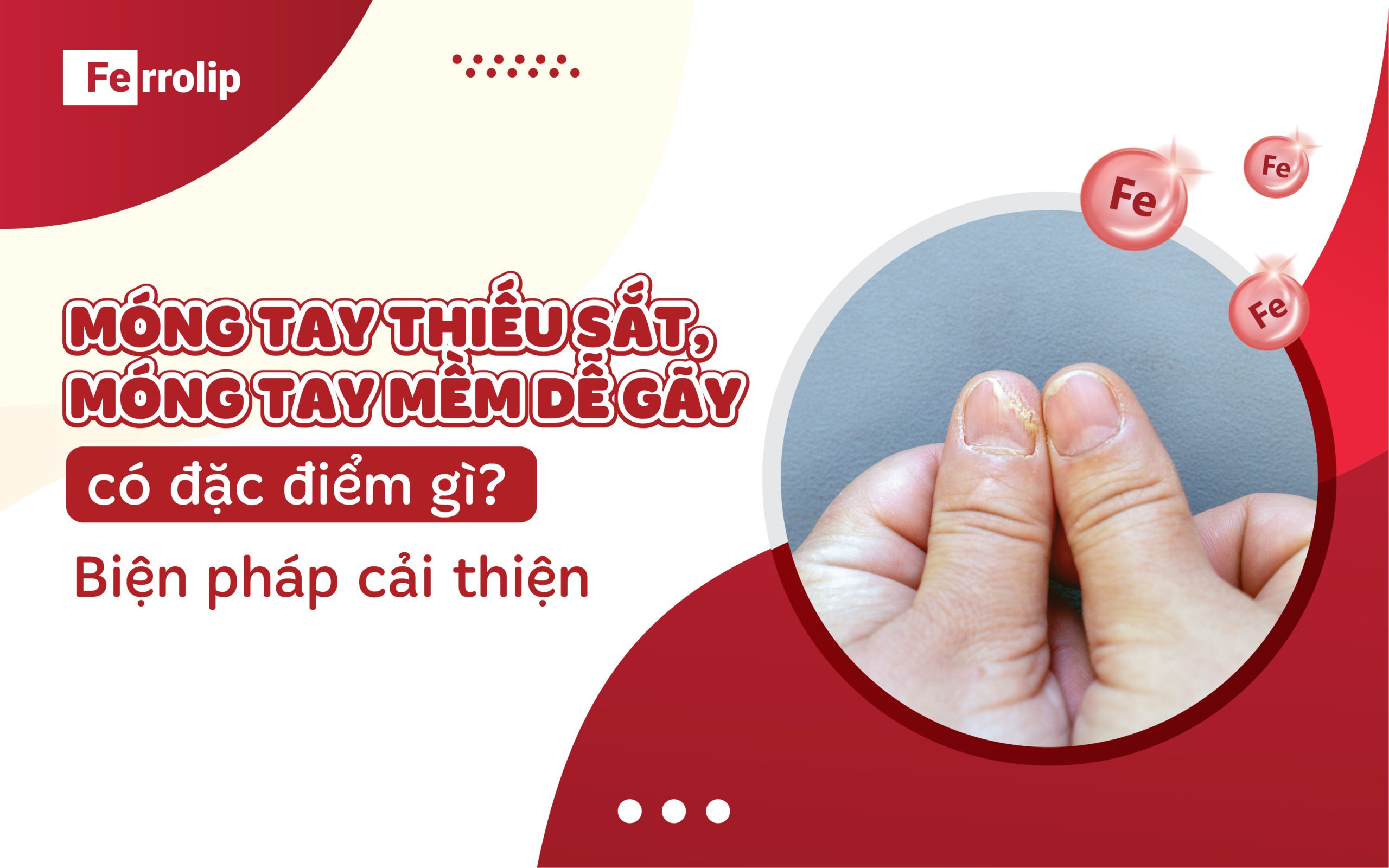 móng tay thiếu sắt có đặc điểm như thế nào