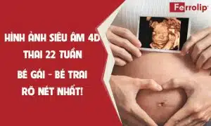 Hình ảnh siêu âm 4D thai 24 tuần