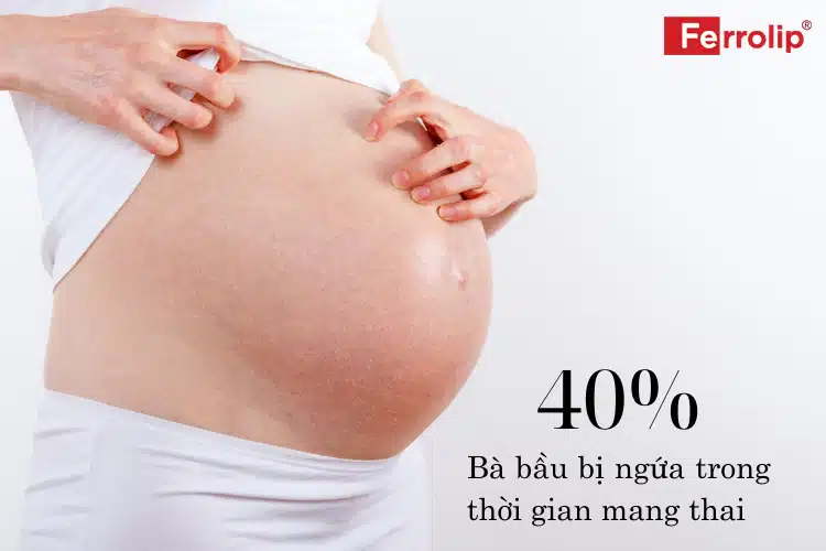 40% bà bầu bị ngứa trong thời gian mang thai