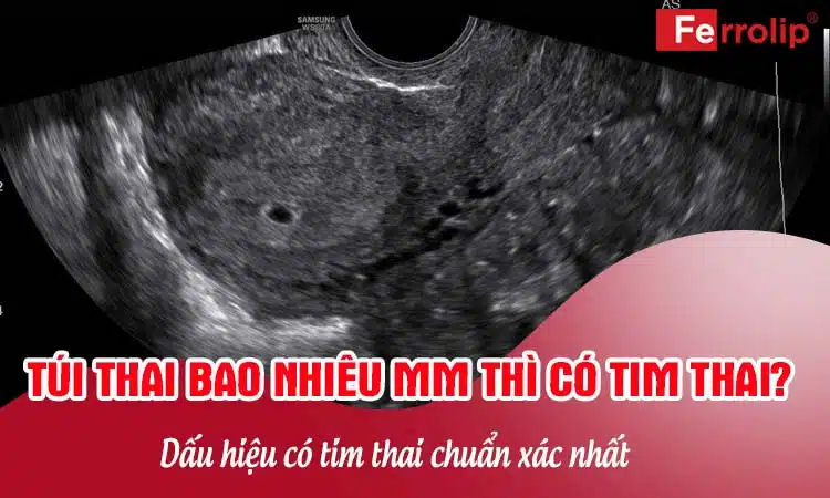 túi thai bao nhiêu mm thì có tim thai