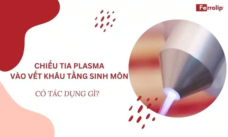 chiếu tia plasma vào vết khâu tầng sinh môn