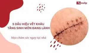 dấu hiệu vết khâu tầng sinh môn đang lành