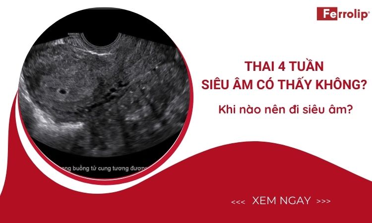 thai 4 tuần siêu âm có thấy không