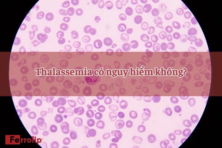 Mức độ nguy hiểm của Thalassemia phụ thuộc vào nhiều yếu tố