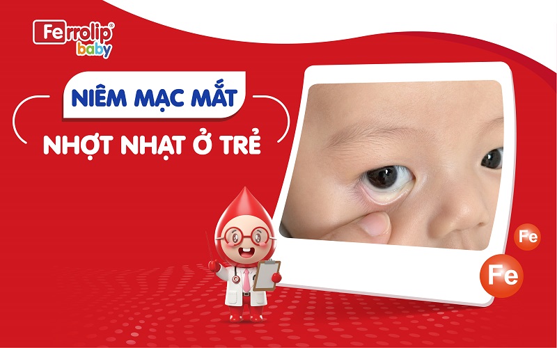 Niêm mạc mắt nhợt nhạt ở trẻ