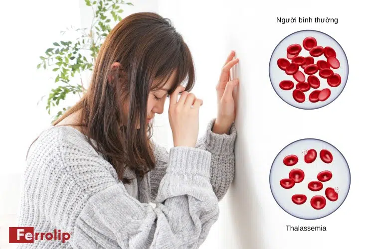 Tan máu bẩm sinh hay còn gọi là Thalassemia