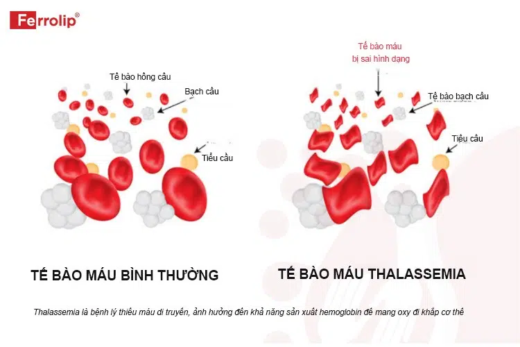 tế bào máu trong thalassemia