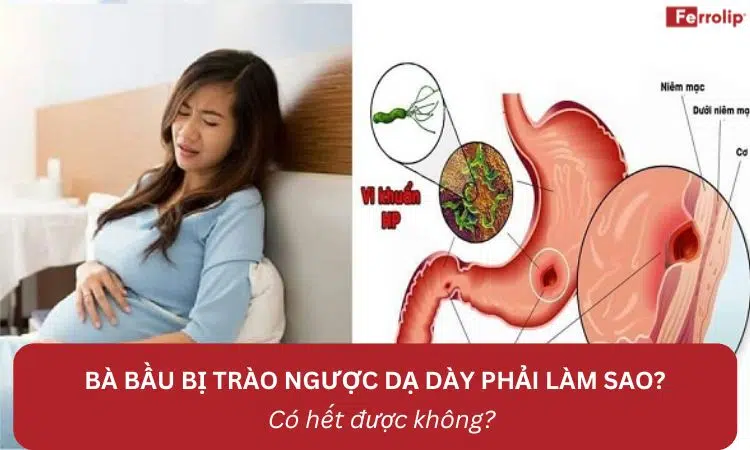 bà bầu bị trào ngược dạ dày phải làm sao