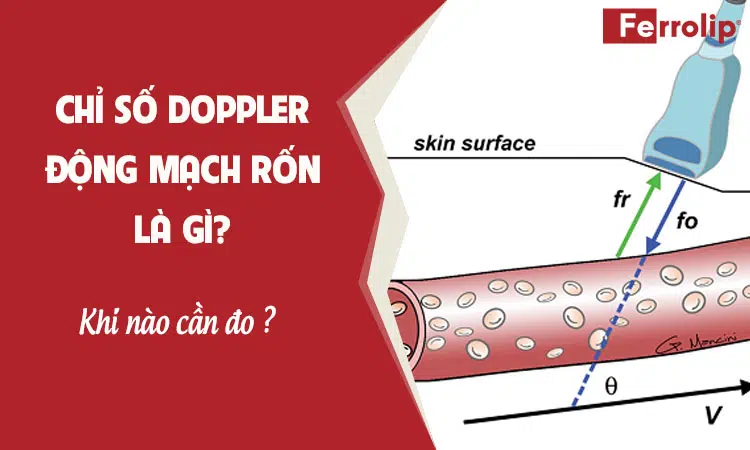 chỉ số doppler đm rốn pi