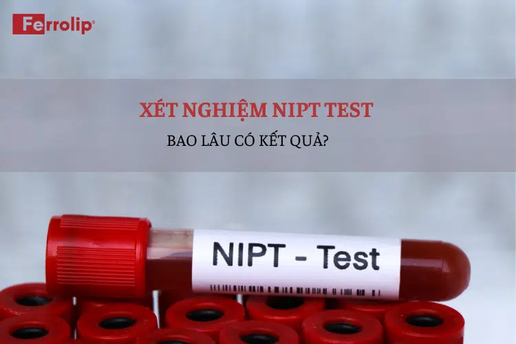 Xét nghiệm NIPT bao lâu có kết quả?