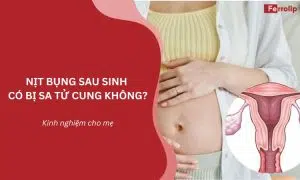 nịt bụng sau sinh có bị sa tử cung không