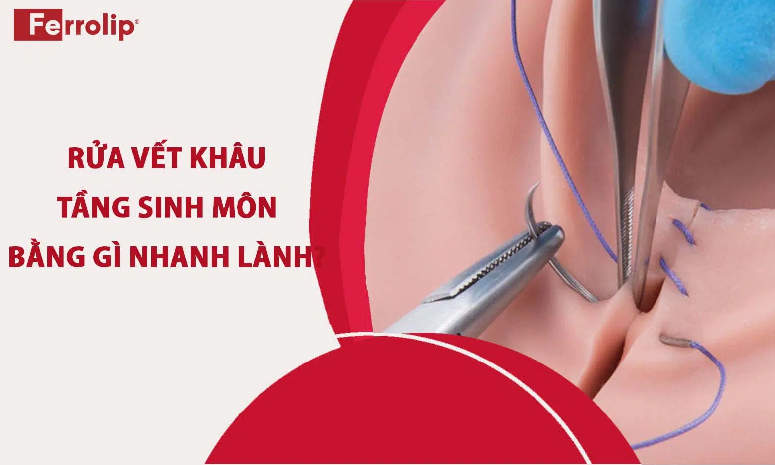 Rửa vết khâu tầng sinh môn bằng gì