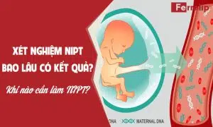 xét nghiệm nipt bao lâu có kết quả