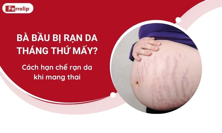 bà bầu bị rạn da tháng thứ mấy