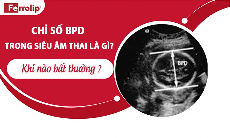 chi-so-bpd-trong-sieu-am-thai-la-gi