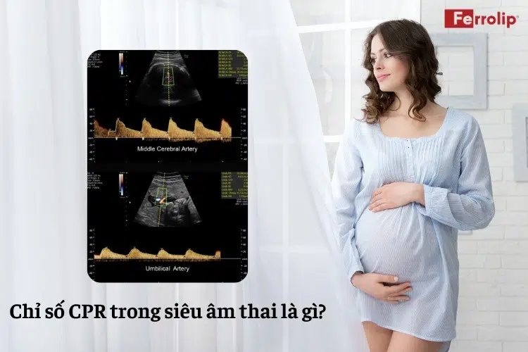 chỉ số CPR trong siêu âm thai