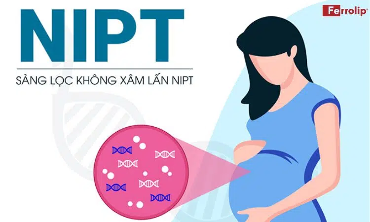xét nghiệm NIPT biết được gì