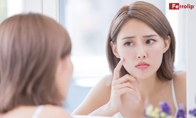 mặt nổi mụn khi mang thai