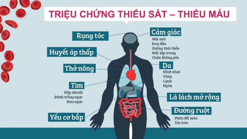 Triệu chứng thiếu sắt - thiếu máu
