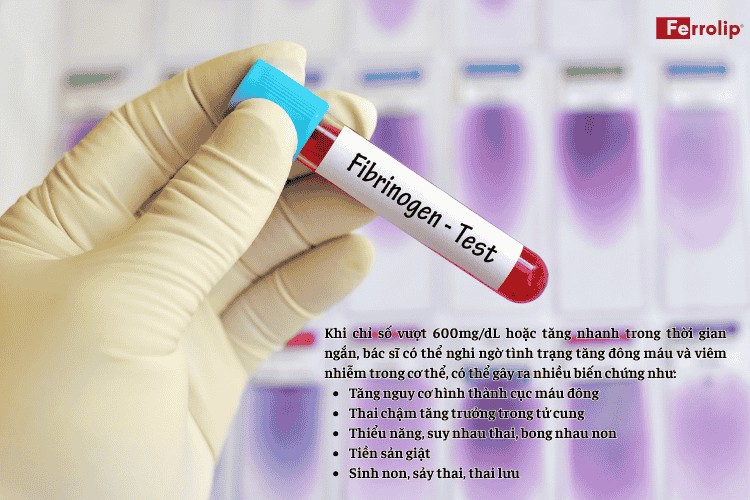 Fibrinogen cao khi mang thai