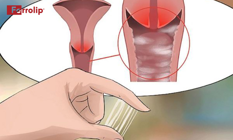 ra dịch vàng khi mang thai tháng cuối