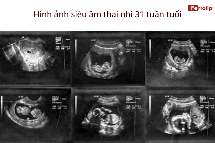 hình ảnh thai nhi tuần 31 trong bụng mẹ
